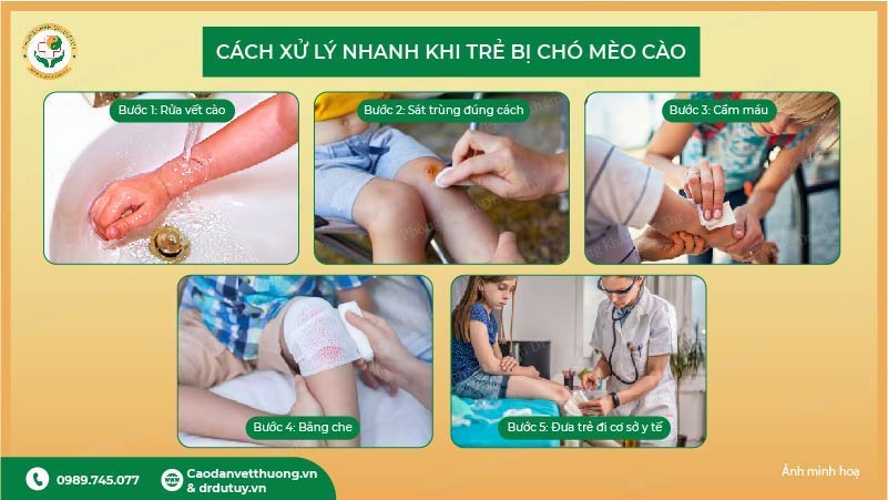 5 bước sơ cứu khi trẻ bị chó mèo cào
