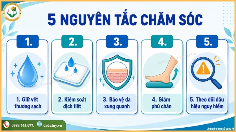 5 nguyên tắc chăm sóc vết loét chân