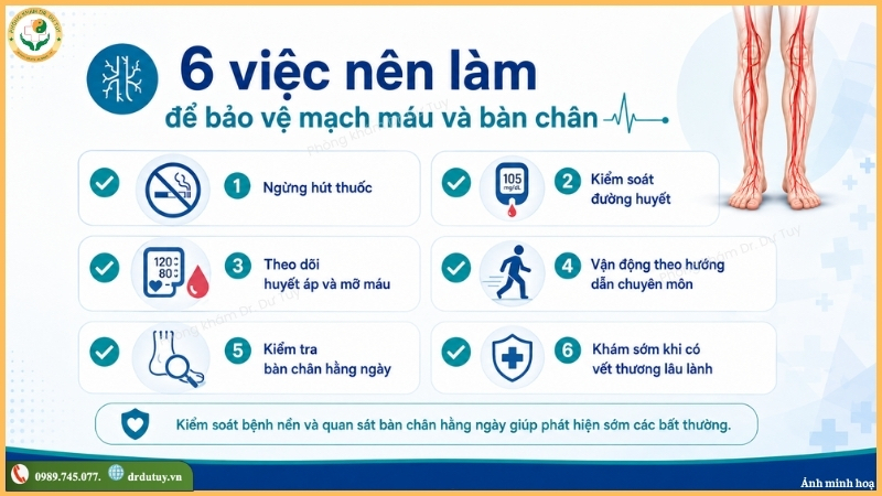 6 cách phòng ngừa tắc mạch chi dưới