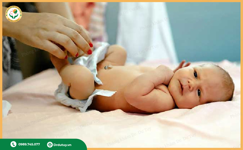 áp xe hậu môn ở trẻ sơ sinh