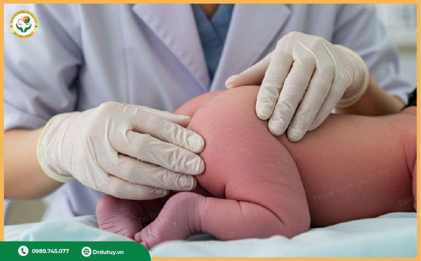 áp xe hậu môn ở trẻ sơ sinh