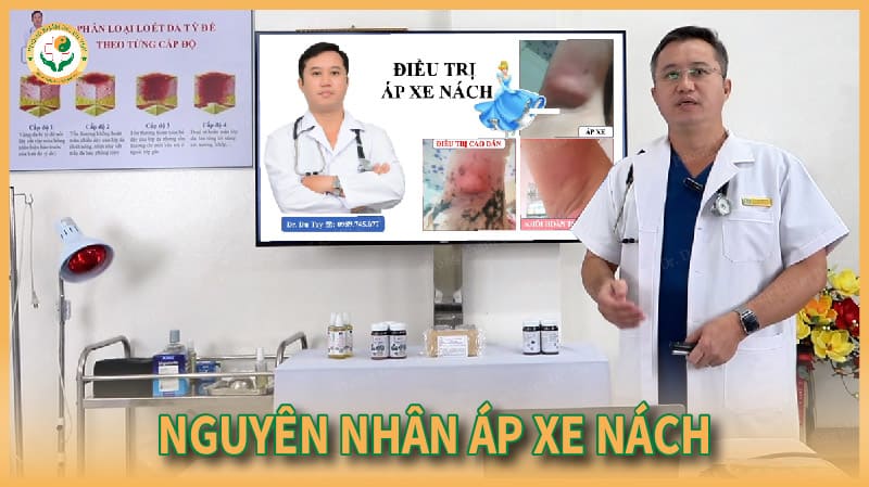 áp xe nách là gì?