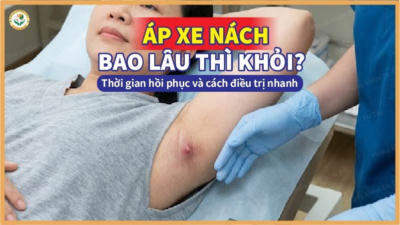áp xe nách là gì?