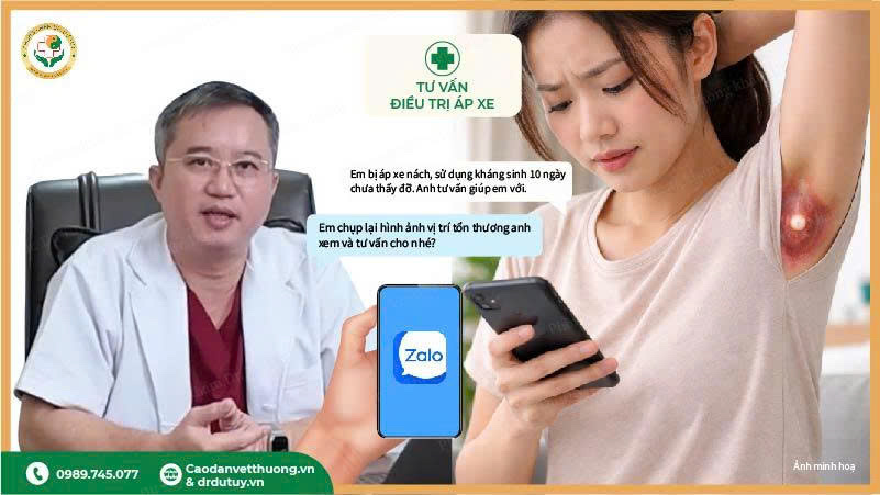 áp xe nách sưng đỏ đau