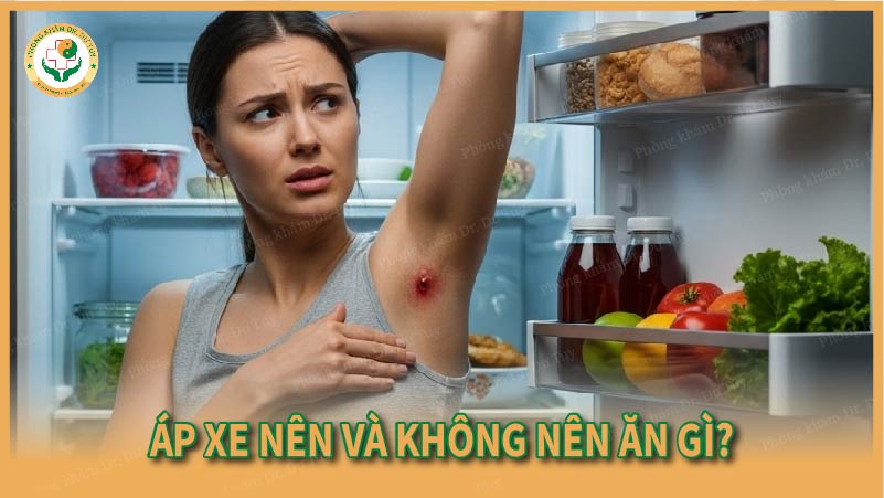 Áp xe nên và không nên ăn gì?