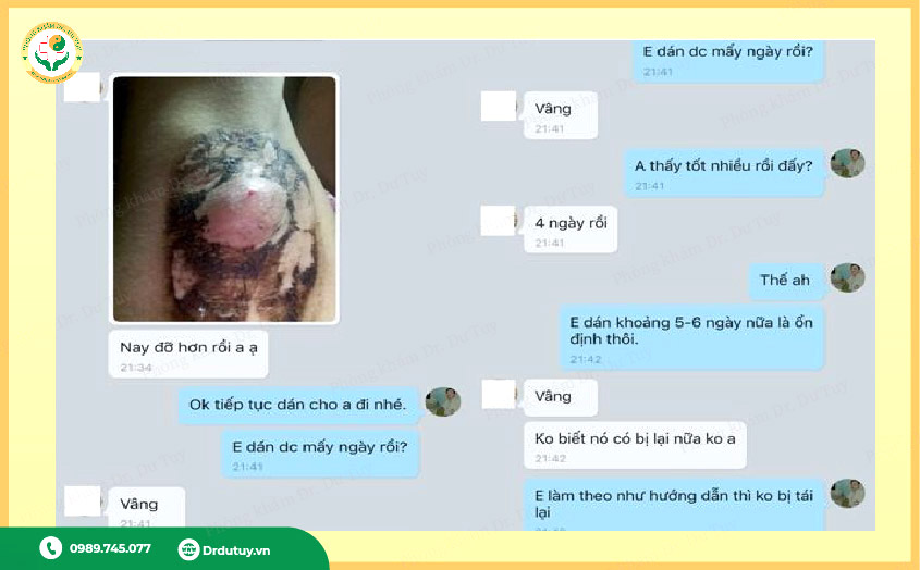 áp xe sauu 4 ngày cải thiện