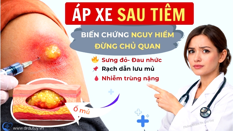 Áp xe sau tiêm- Biến chứng nguy hiểm dễ bị bỏ qua nếu chủ quan