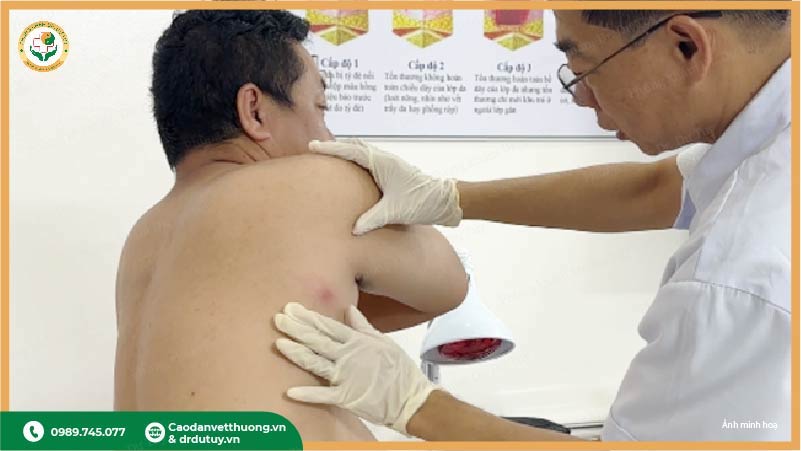 bác sĩ điều trị áp xe