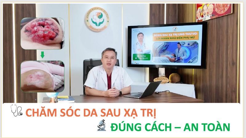 Bỏng da sau xạ trị ung thư vú: Ca bệnh thực tế và hướng phục hồi an toàn