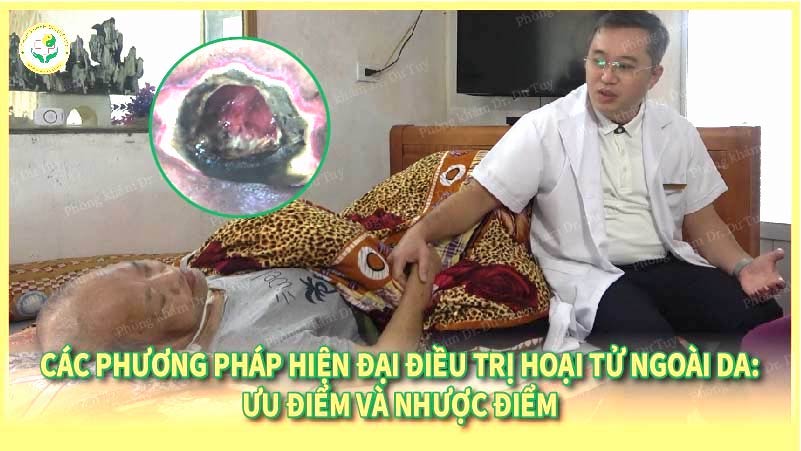 Các phương pháp hiện đại điều trị hoại tử ngoài da: ưu điểm và nhược điểm 