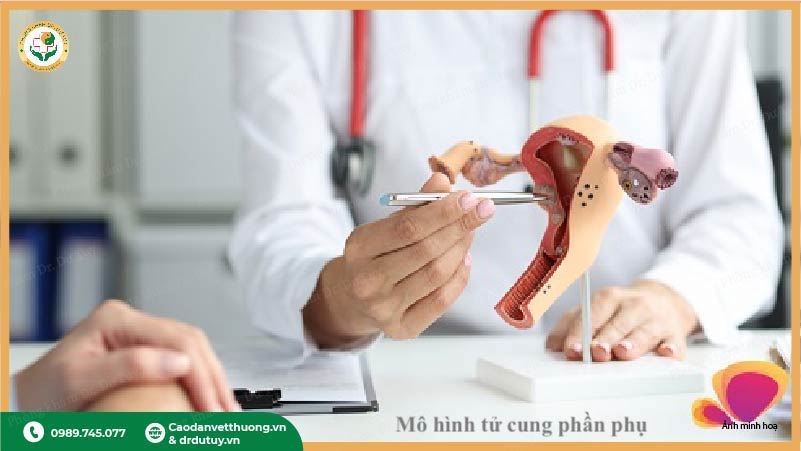 bác sĩ tư vấn pcos buồng trứng đa nang