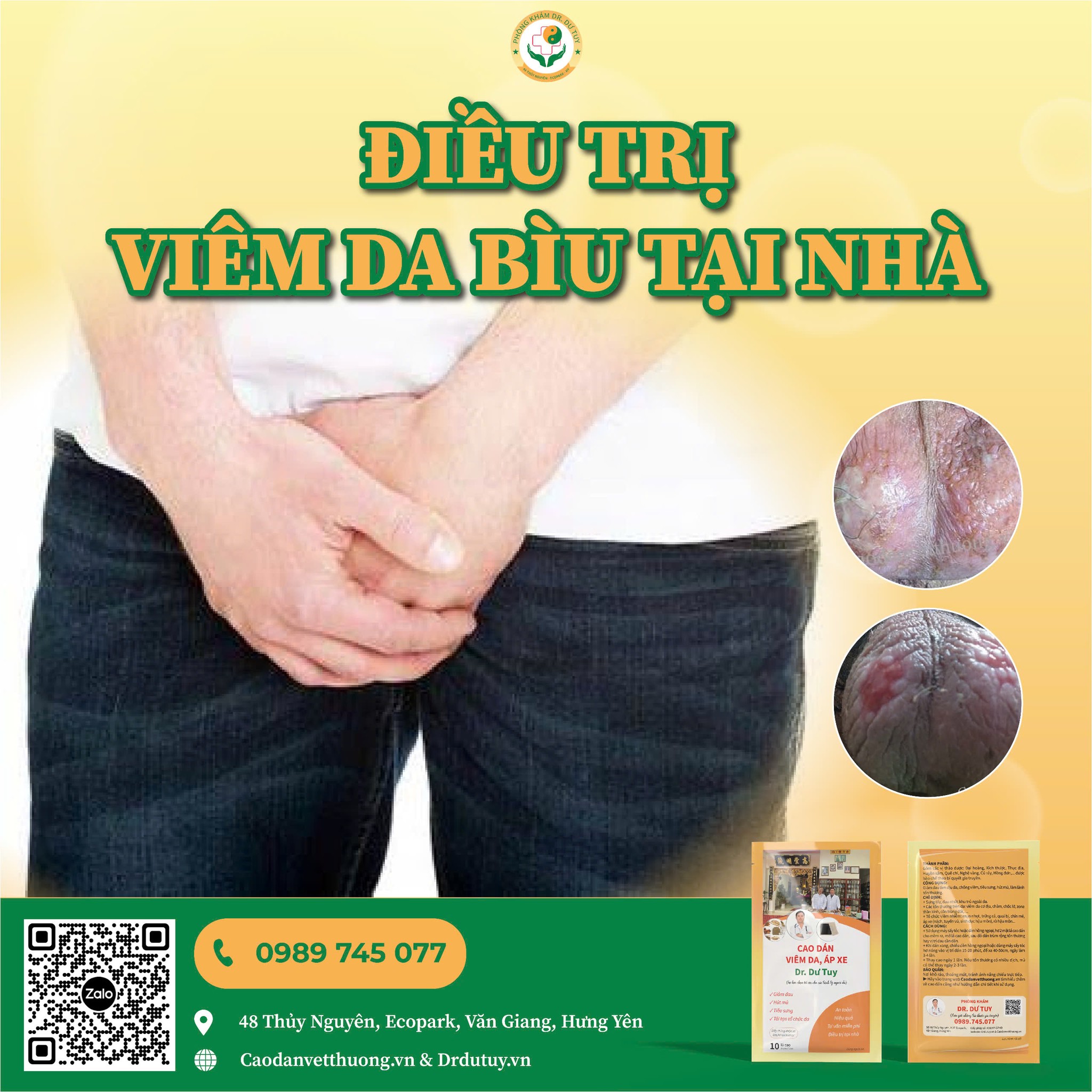 Bật mí cách trị viêm da bìu tại nhà, hiệu quả nhanh