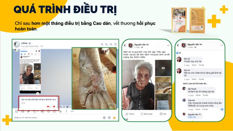bệnh da liễu sau lũ