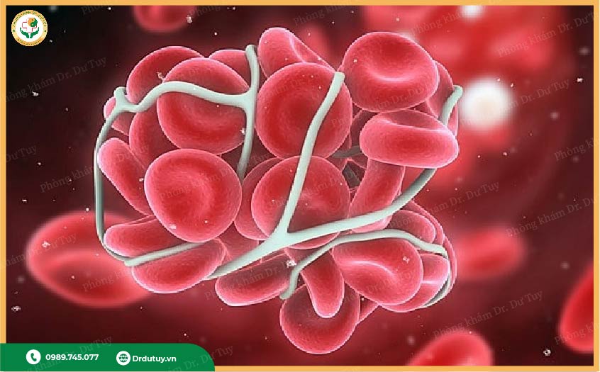 bệnh lý tiểu cầu