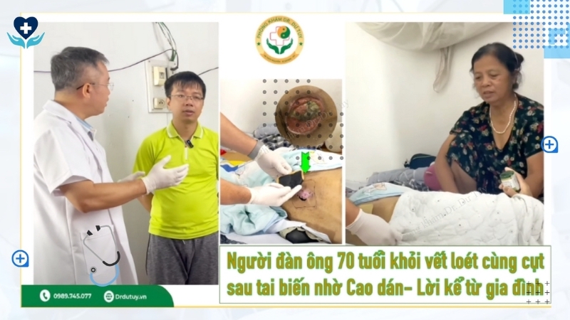 bệnh nhân 70 tuổi loét cùng cụt sau tai biến