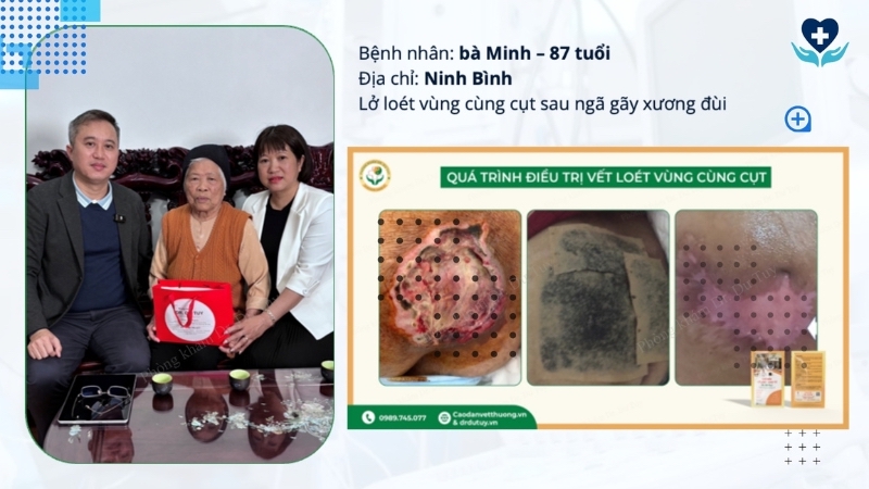 bệnh nhân 87 tuổi loét cùng cut
