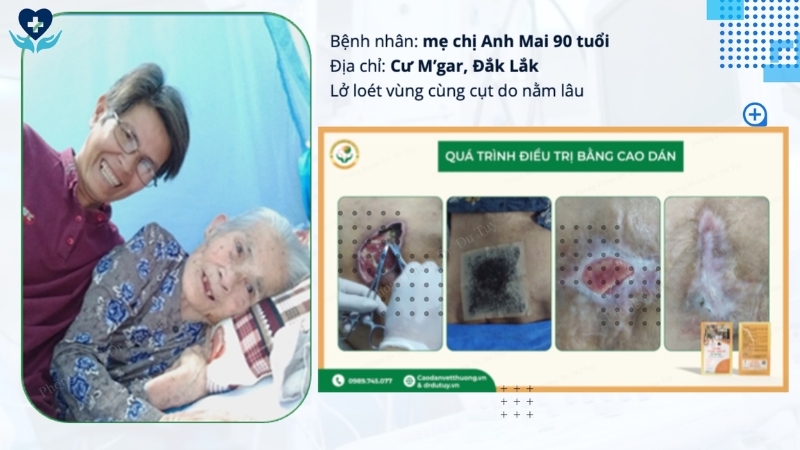 bệnh nhân 90 tuổi loét tỳ đè