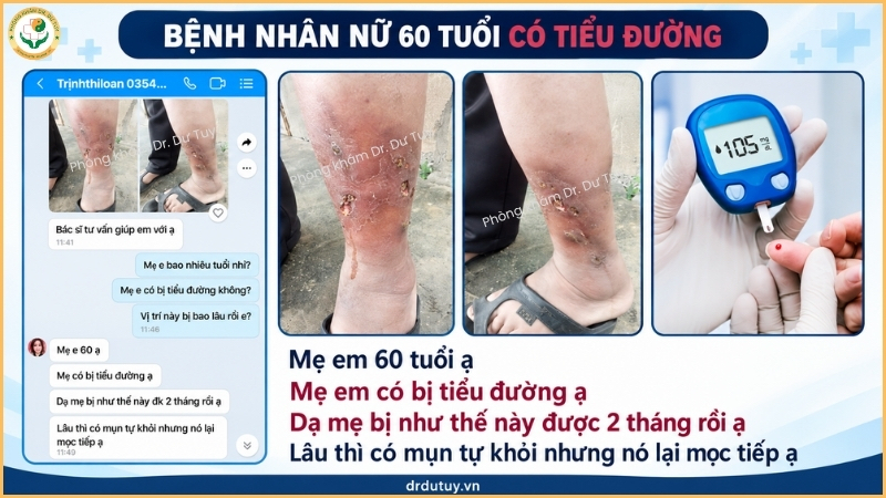bệnh nhân nữ 60 tuổi tiểu đường