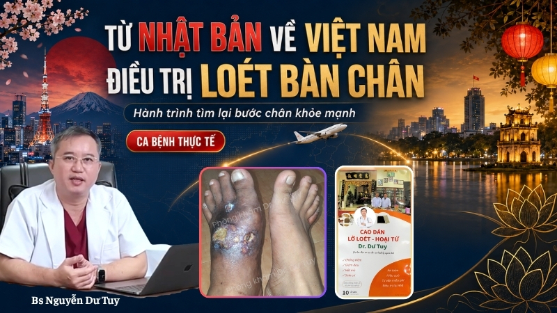 Từ Nhật Bản về Việt Nam điều trị loét bàn chân do suy giãn tĩnh mạch: Hành trình phục hồi qua hình ảnh thực tế