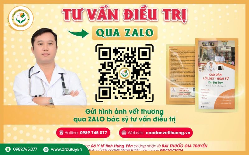 Làm sao để mua cao dán Dr Dư Tuy?