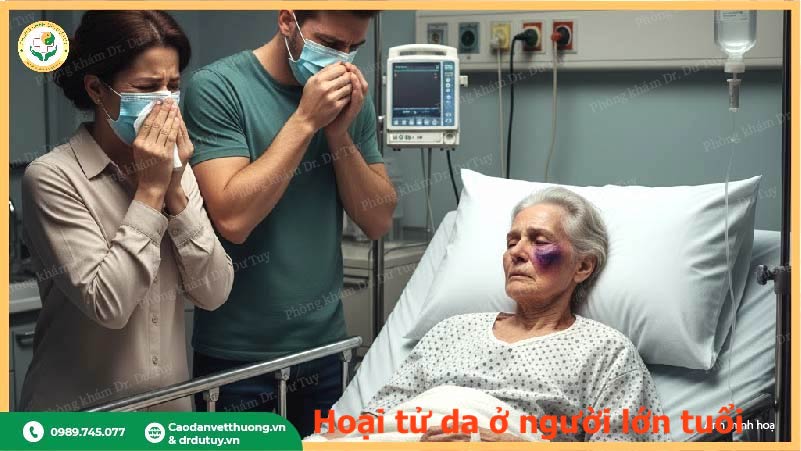 biến chứng hoại tử da nghiêm trọng cần nhập viện