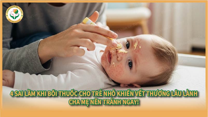 4 sai lầm khi bôi thuốc cho trẻ nhỏ khiến vết thương lâu lành – Cha mẹ nên tránh ngay!