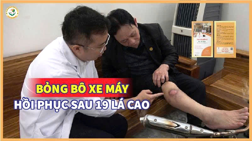 Bỏng bô xe máy hồi phục sau 19 lá Cao dán