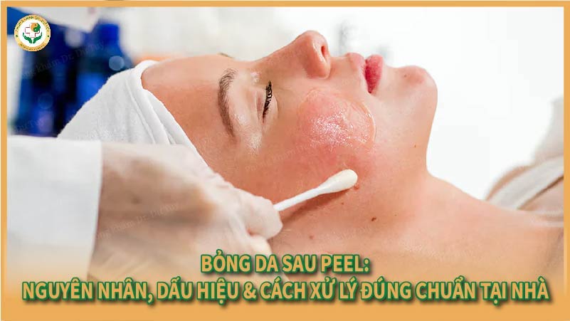 Bỏng da sau Peel: Nguyên nhân, dấu hiệu & cách xử lý đúng chuẩn tại nhà