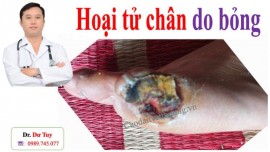 Bỏng điện do đâu? Cách chữa bỏng điện