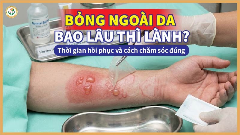 Bỏng ngoài da bao lâu thì lành? Thời gian hồi phục và cách chăm sóc đúng