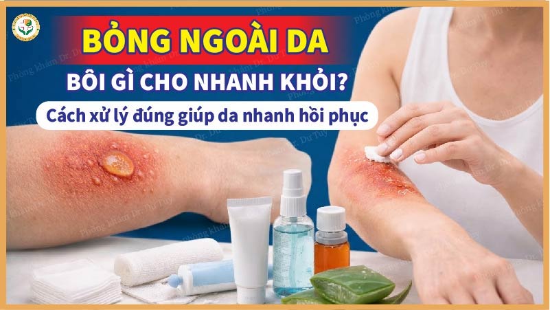 Bỏng ngoài da bôi gì cho nhanh khỏi? Cách xử lý đúng giúp da nhanh hồi phục