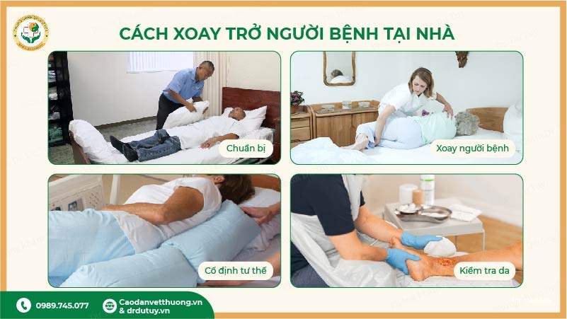 các bước xoay trở người bệnh tại nhà