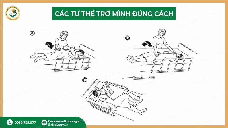 các tư thế trở mình đúng cách cho người nằm lâu