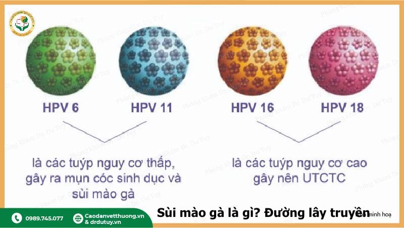 các type hpv gây sùi mào gà