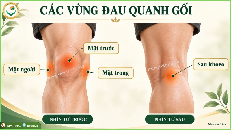 các vị trí đau quanh khớp gối