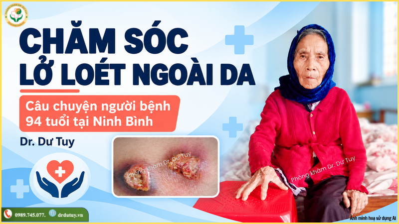 cách chăm sóc lở loét ngoài da