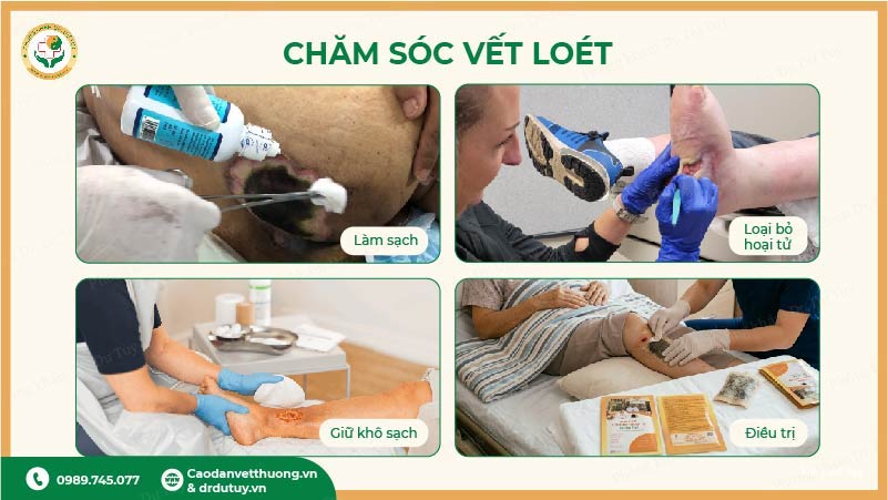cách chăm sóc vết loét bị chảy mủ