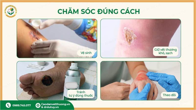 cách chăm sóc vết thương đúng cách