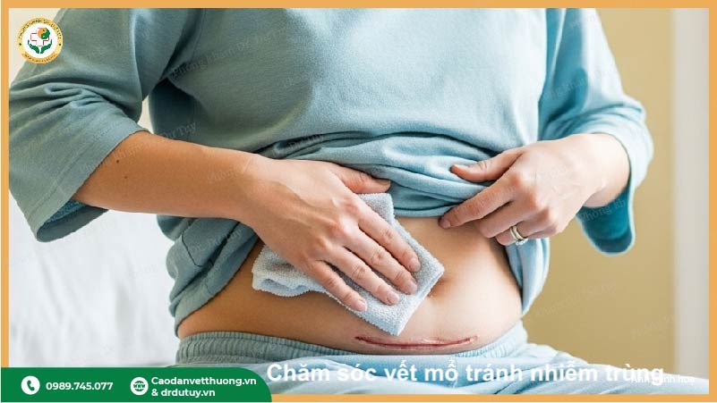 cách chăm sóc vết thương sau phẫu thuật tạo hình thành bụng