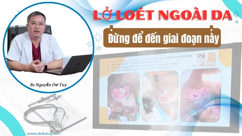 cách chữa lở loét da tại nhà