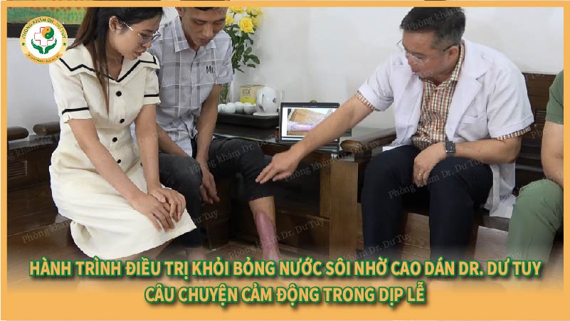 cách điều trị bỏng tại nhà