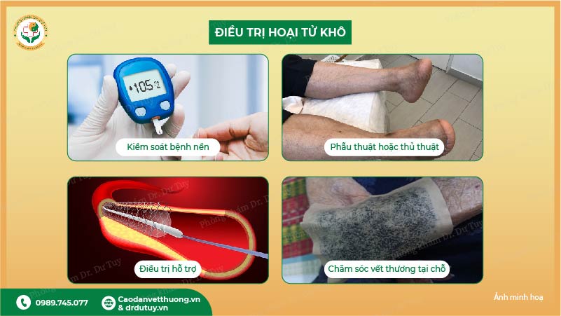 cách điều trị hoại tử da