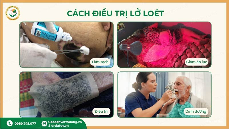 cách điều trị lở loét ngoài da