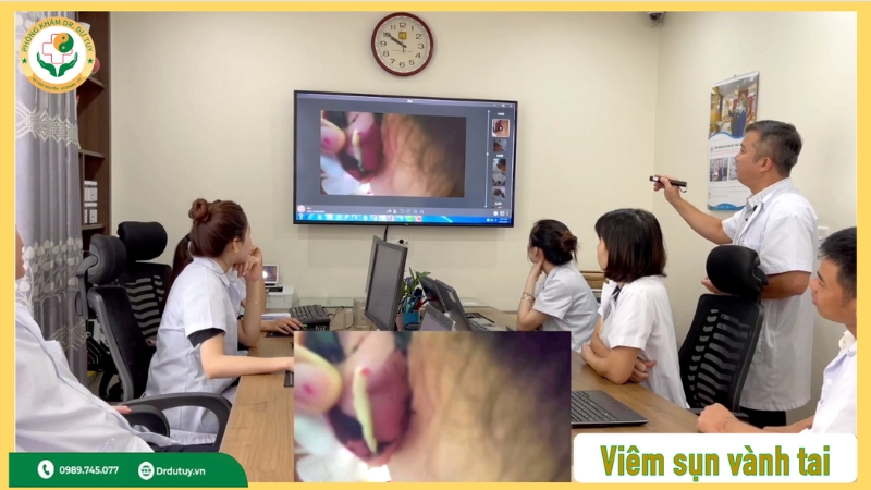 cách điều trị viêm sụn vành tai