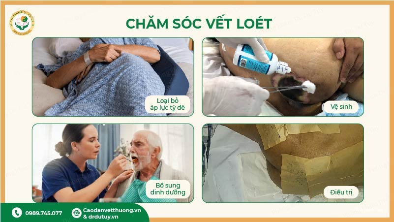 cách giúp vết loét nhanh lành không để nặng hơn