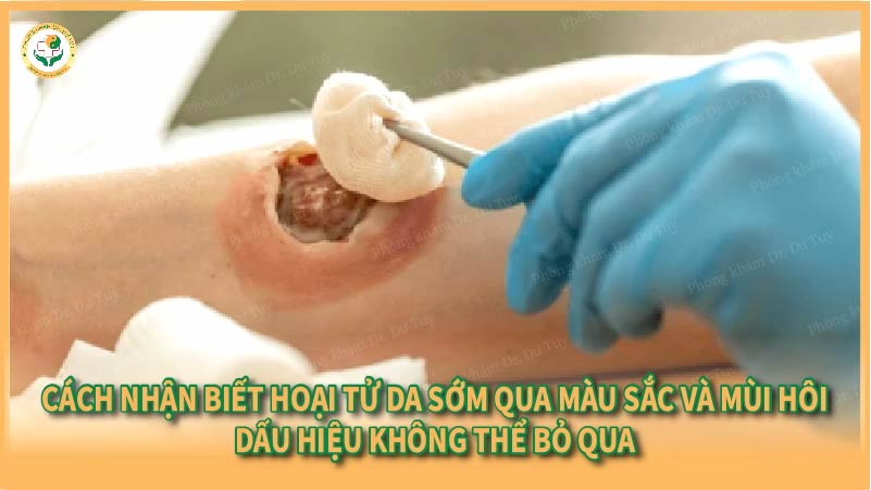 Cách nhận biết hoại tử da sớm qua màu sắc và mùi hôi – dấu hiệu không thể bỏ qua