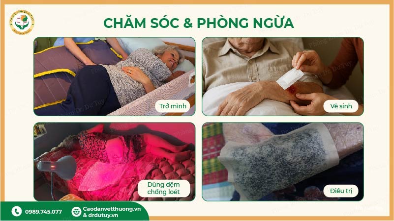 cách phòng ngừa loét tì đè cho người nằm lâu