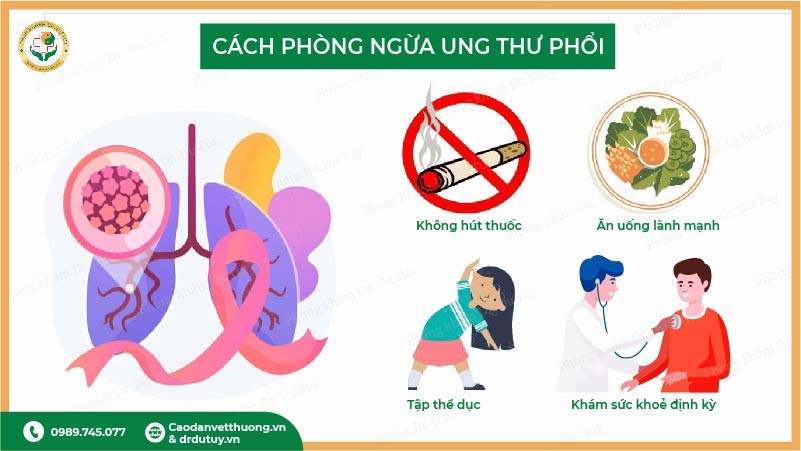 cách phòng ngừa ung thư phổi không hút thuốc khám sức khoẻ