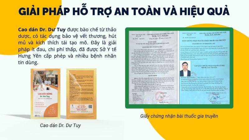 cách trị bỏng nhanh khỏi