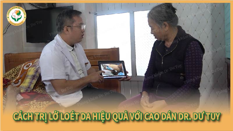 Cách trị lở loét da hiệu quả với Cao dán Dr. Dư Tuy